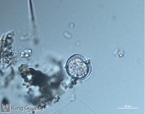 Photo of Diplopsalid dinoflagellates
